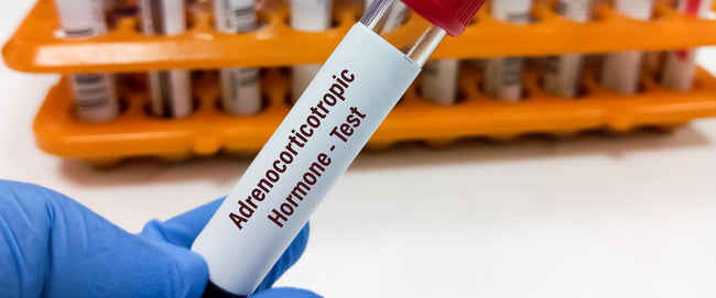 Balancing Hormones for Optimal Fitness: Natural Solutions